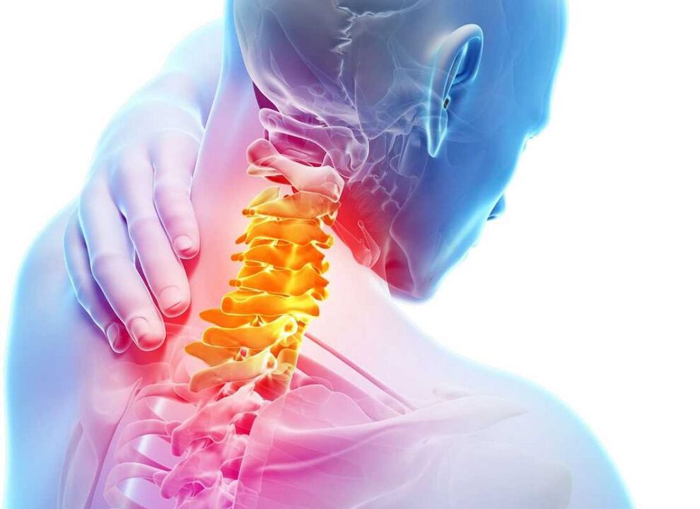 ból kręgosłupa szyjnego z osteochondrozą