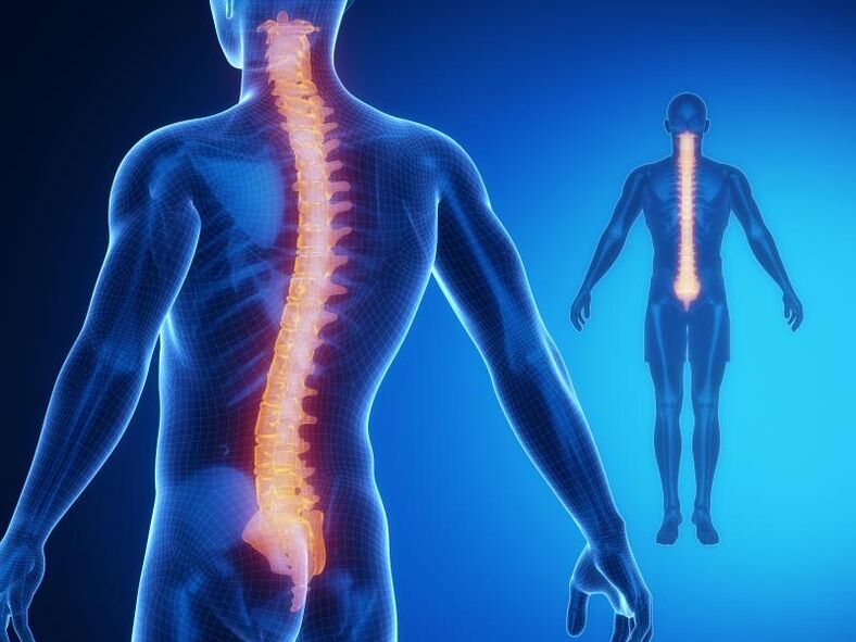 Osteochondroza kręgosłupa wymagająca kompleksowego leczenia
