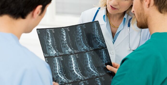 RTG kręgosłupa jako sposób diagnozowania osteochondrozy