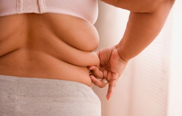 nadwaga, przyczyna osteochondrozy szyjki macicy u kobiet poniżej 40 roku życia